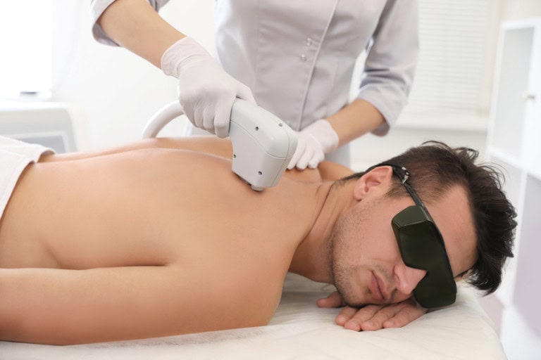 man back hair removal